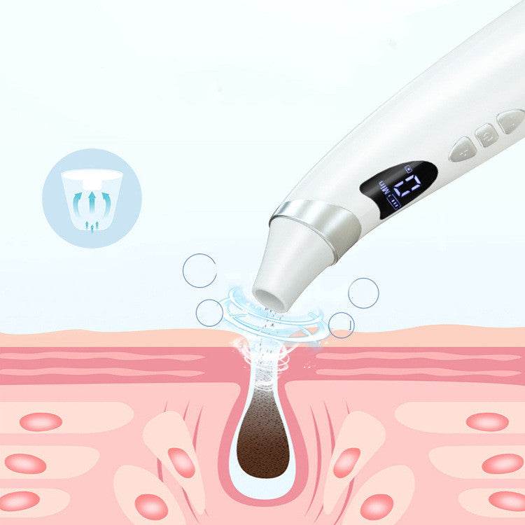 Blackhead Suction Instrument - Strong & Visual Cleansing Pore Cleaner.