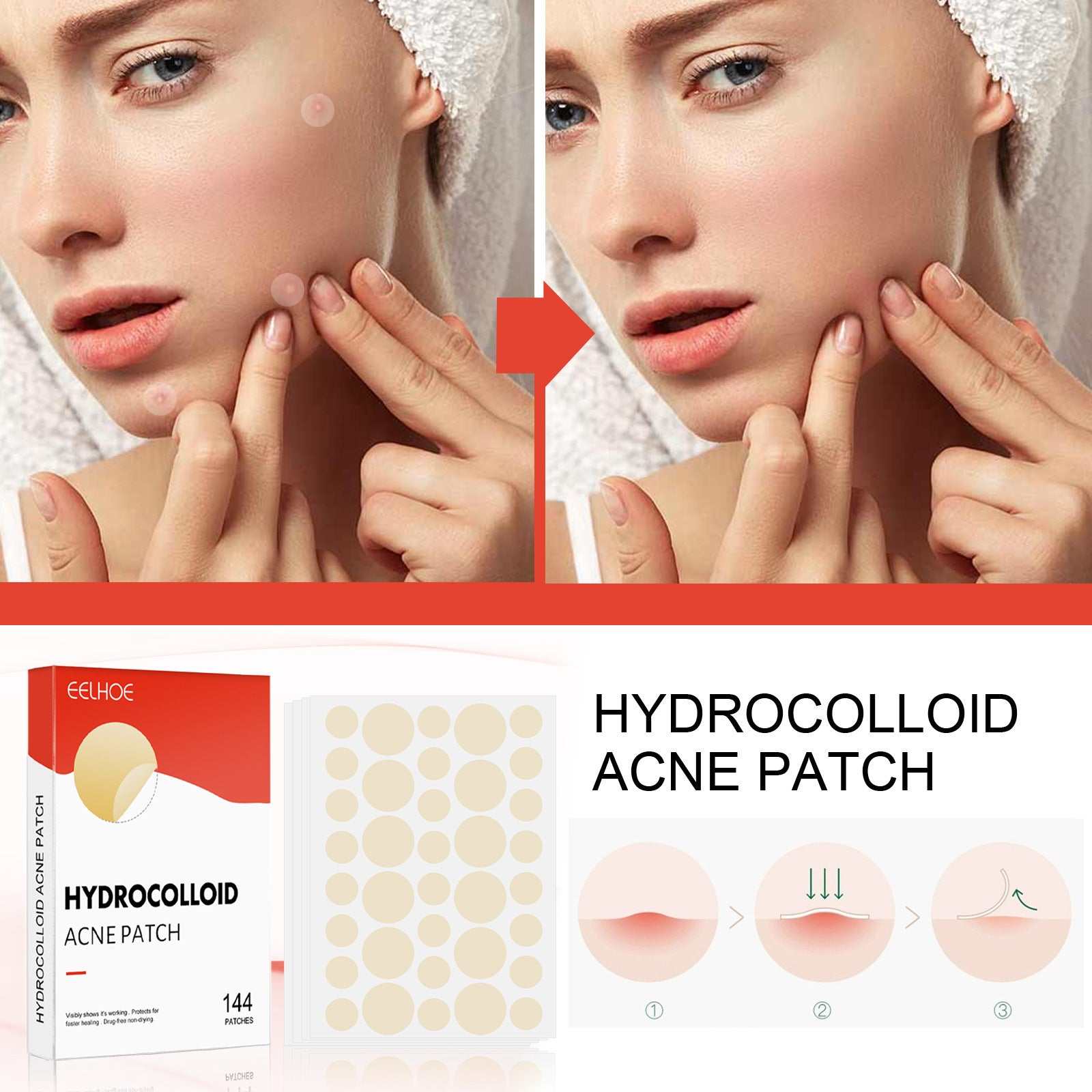 Invisible Breathable Repair Hydrogel --For Acne Patches, easy to use .