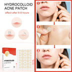 Invisible Breathable Repair Hydrogel --For Acne Patches, easy to use .