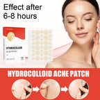 Invisible Breathable Repair Hydrogel --For Acne Patches, easy to use .