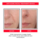 Beauty Instrument --Pore Convergence Micro Current EMS Rejuvenation ..