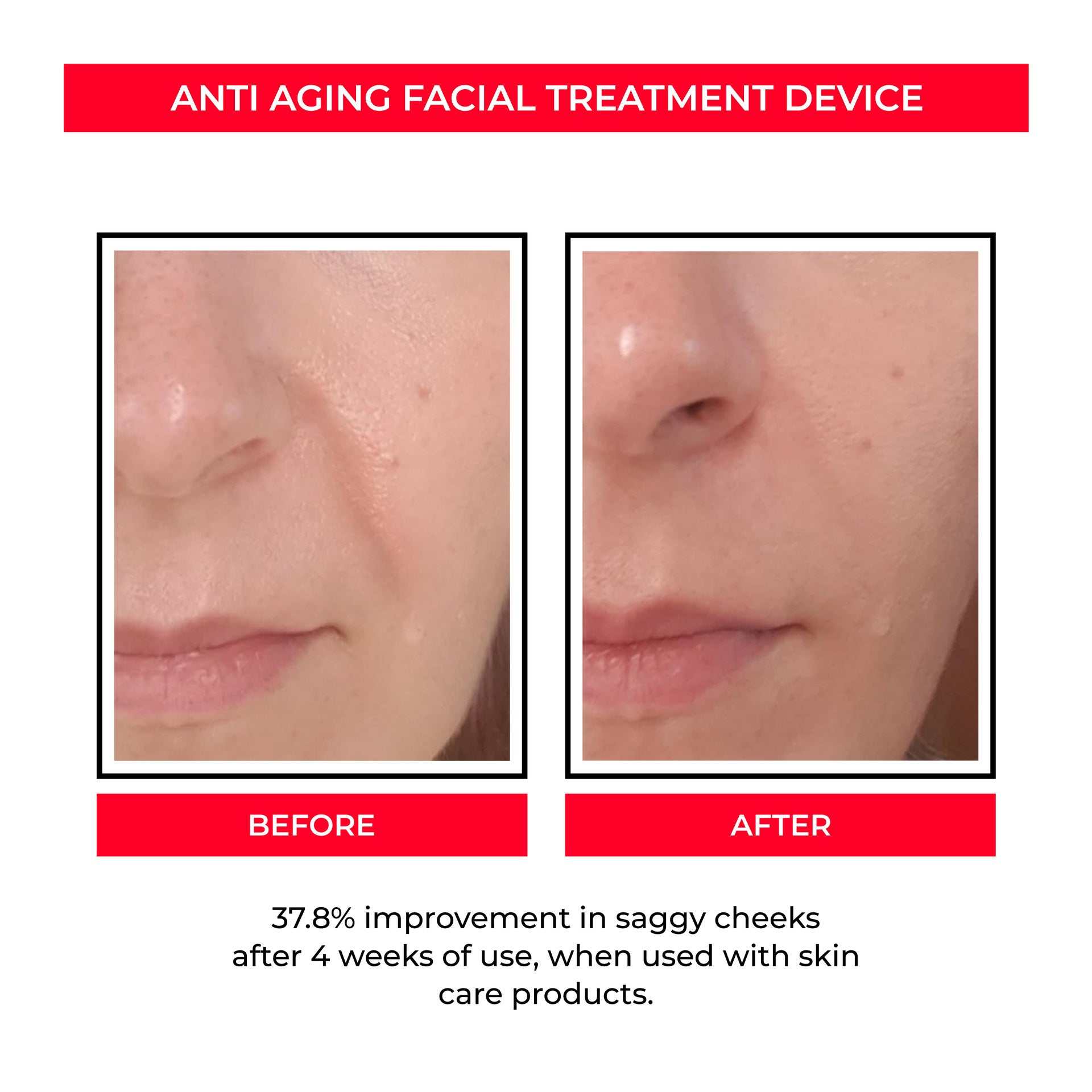 Beauty Instrument --Pore Convergence Micro Current EMS Rejuvenation ..
