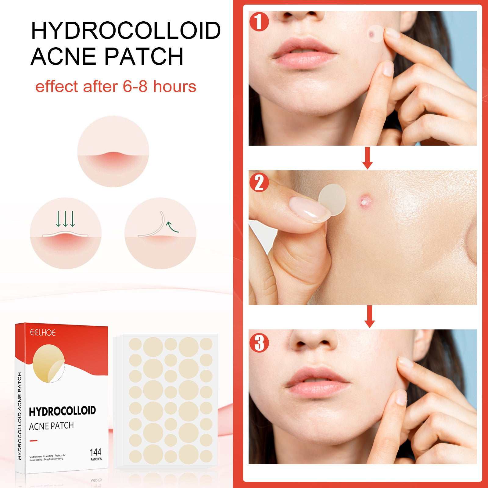 Invisible Breathable Repair Hydrogel --For Acne Patches, easy to use .